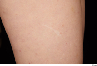 Rania nude scar skin 0001.jpg